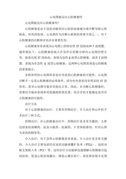 心电图能反应心肌梗塞吗