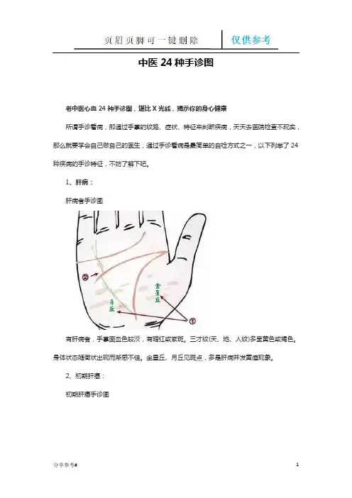 中医24种手诊图(学习类别)