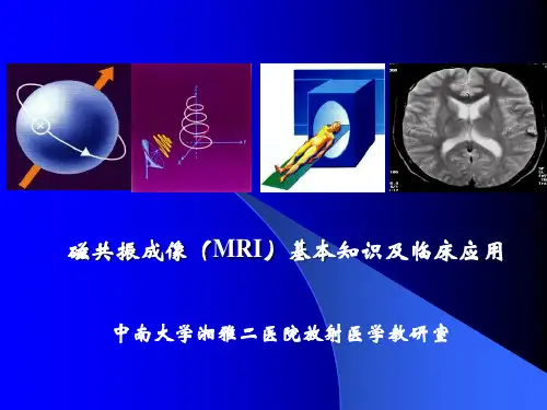 磁共振成像(MRI)基本知识及临床应用