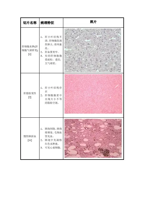 病理切片