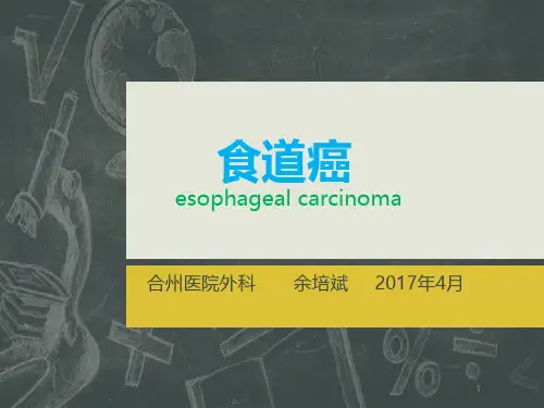 食道癌PPT课件