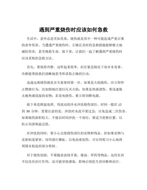 遇到严重烧伤时应该如何急救