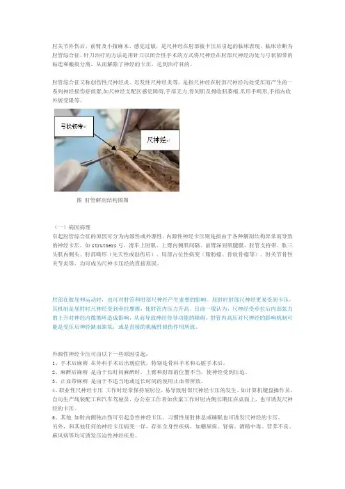 针刀治疗肘管综合症机理及临床操作(图文)