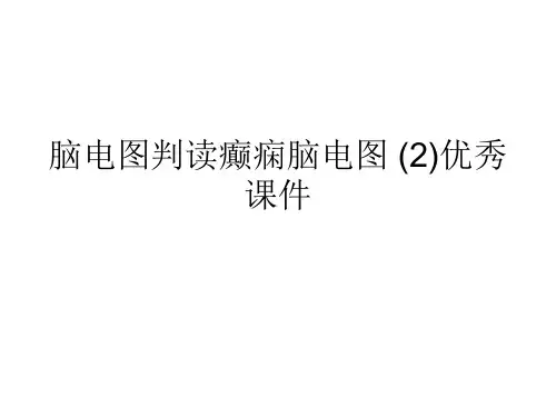 脑电图判读癫痫脑电图 (2)优秀课件