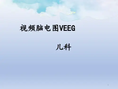 视频脑电图PPT课件
