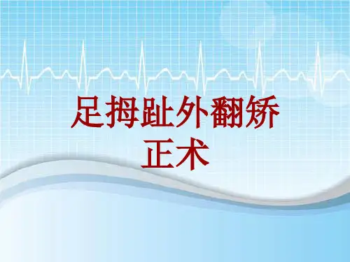 手术讲解模板：足拇趾外翻矫正术
