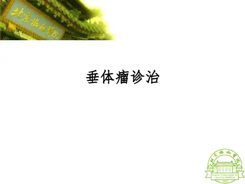 垂体瘤诊治