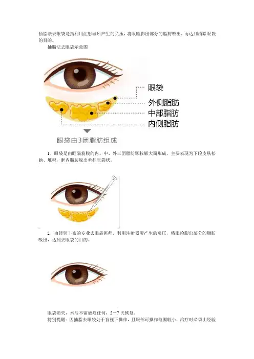 非手术去眼袋的方法