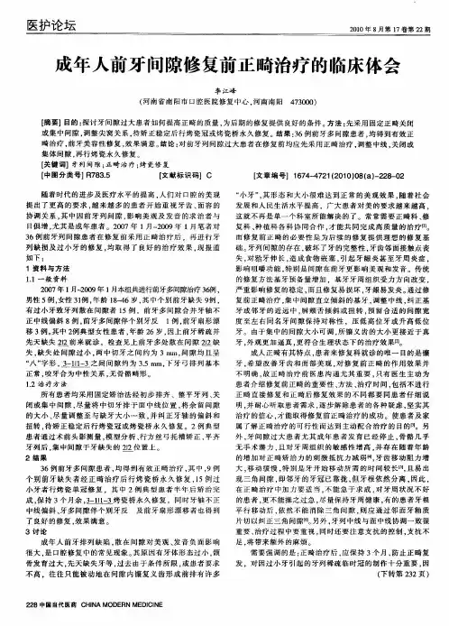 成年人前牙间隙修复前正畸治疗的临床体会