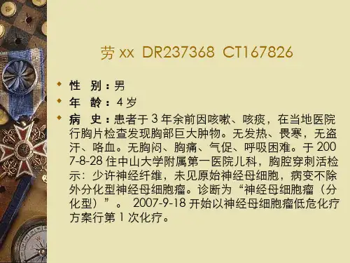 纵隔病例讨论