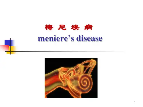 梅尼埃病及头晕详解ppt课件