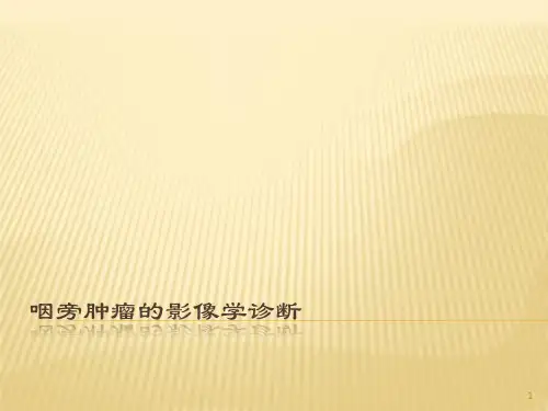 咽旁肿瘤的影像学诊断ppt课件