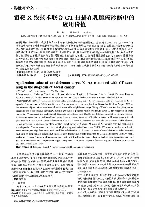 钼靶X线技术联合CT扫描在乳腺癌诊断中的应用价值