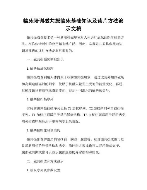 临床培训磁共振临床基础知识及读片方法演示文稿
