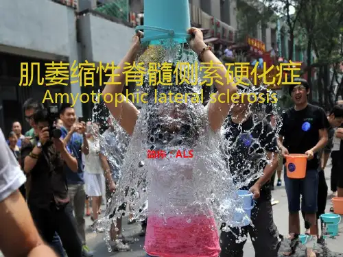 肌萎缩性脊髓侧索硬化症ppt课件