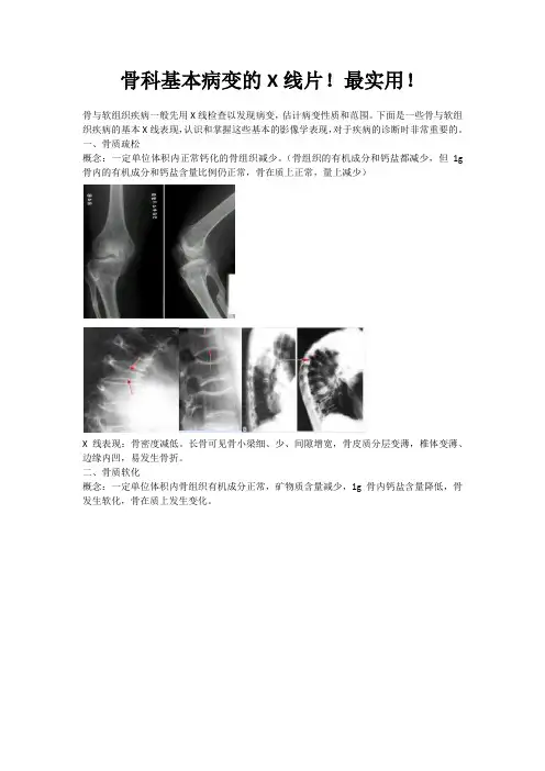 骨科常见疾病的X线表现