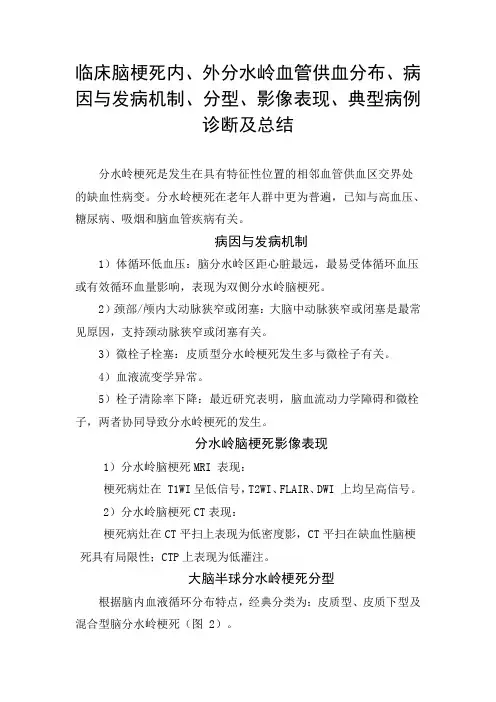 临床脑梗死内、外分水岭血管供血分布、病因与发病机制、分型、影像表现、典型病例诊断及总结