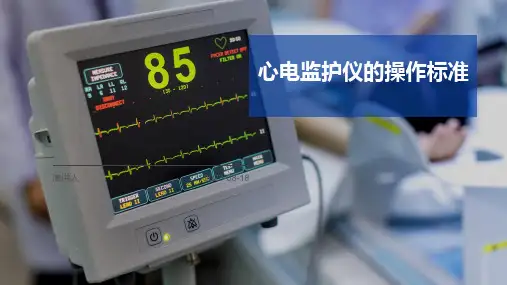 心电监护仪的操作标准