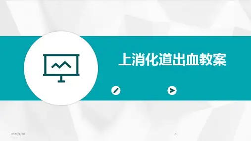 2024版上消化道出血教案