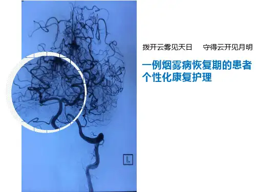 烟雾病护理案例分析