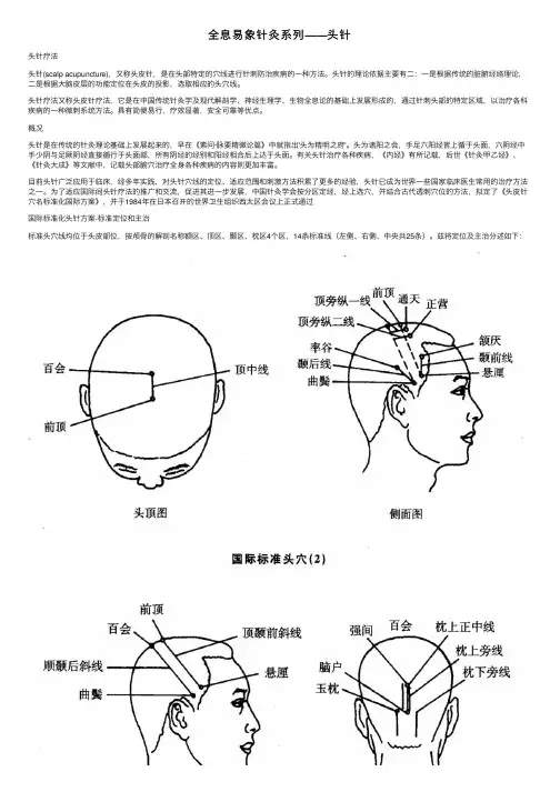 全息易象针灸系列——头针