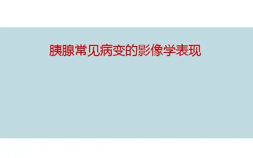 【医学课件】胰腺常见病变的影像学表现