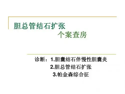 个案查房  胆总管结石扩张