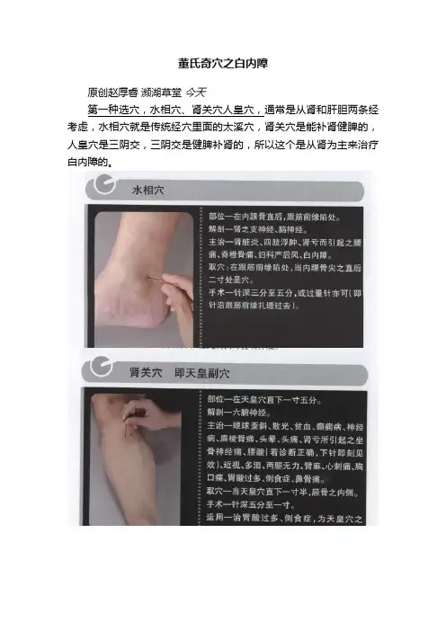 董氏奇穴之白内障
