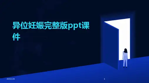 2024版异位妊娠完整版ppt课件