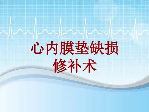 手术讲解模板：心内膜垫缺损修补术
