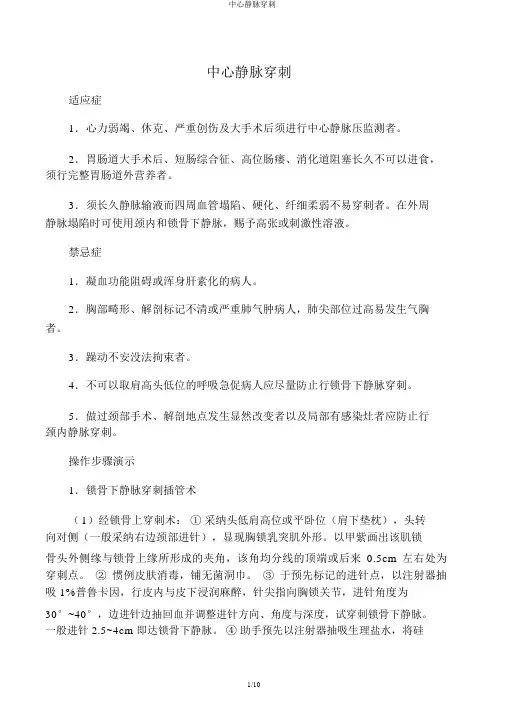 中心静脉穿刺