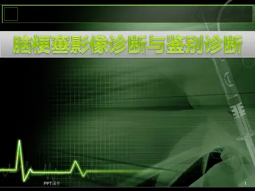 脑梗塞的诊断与鉴别诊断  ppt课件