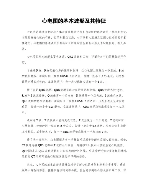 心电图的基本波形及其特征