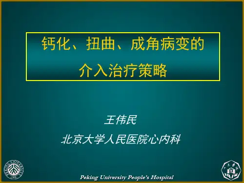 钙化、扭曲、成角病变介入治疗策略