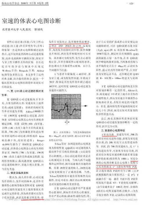 室速的体表心电图诊断_郭继鸿