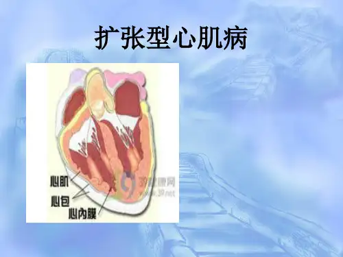 扩张型心肌病查房