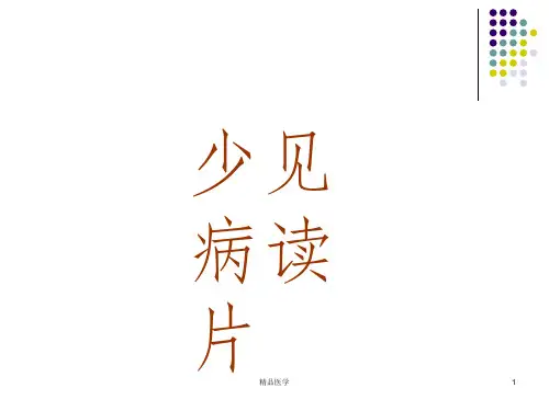《ct少见病读》PPT课件