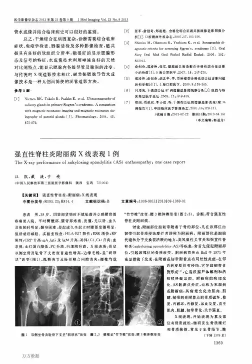 强直性脊柱炎附丽病X线表现1例