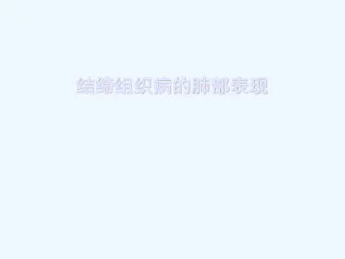 结缔组织病的肺部表现