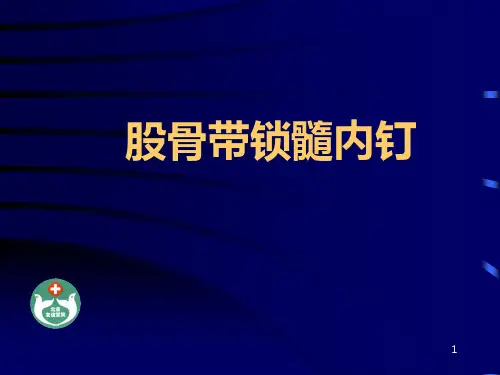 股骨带锁髓内钉PPT课件