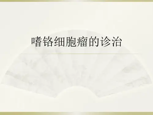 嗜铬细胞瘤