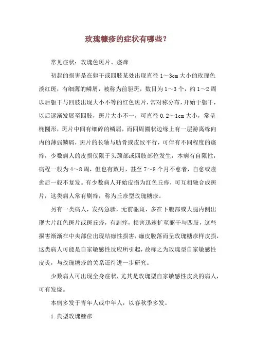 玫瑰糠疹的症状有哪些？