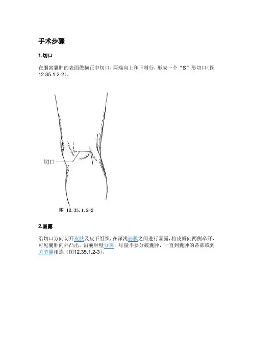 腘窝囊肿手术